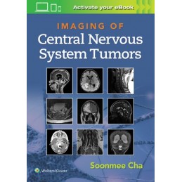 Imaging of Central Nervous...