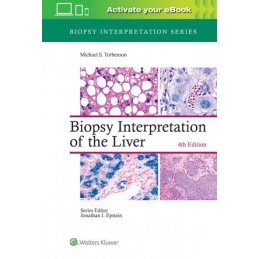 Biopsy Interpretation of the Liver