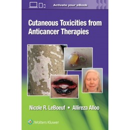 Cutaneous Toxicities from...