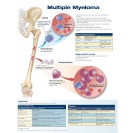 Multiple Myeloma Anatomical...