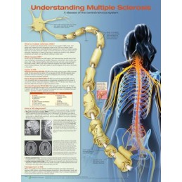 Understanding Multiple...