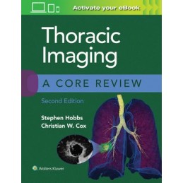 Thoracic Imaging: A Core Review