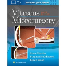 Vitreous Microsurgery