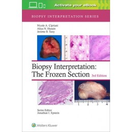 Biopsy Interpretation: The Frozen Section: Print + digital version with Multimedia