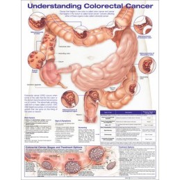 Understanding Colorectal...