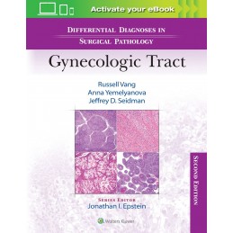 Differential Diagnoses in Surgical Pathology: Gynecologic Tract