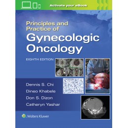 Principles and Practice of Gynecologic Oncology