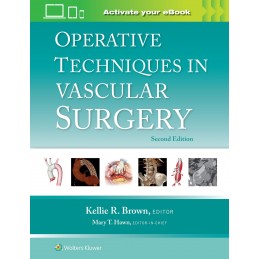 Operative Techniques in Vascular Surgery: Print + digital version with Multimedia