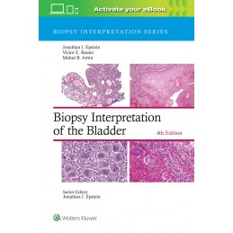 Biopsy Interpretation of the Bladder: Print + digital version with Multimedia