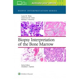 Biopsy Interpretation of the Bone Marrow: Print + digital version with Multimedia