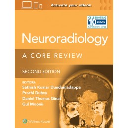 Neuroradiology: A Core Review: Print + digital version with Multimedia