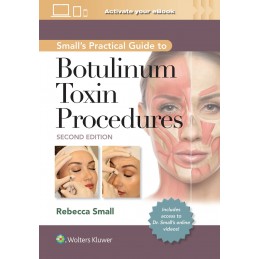 Small's Practical Guide to Botulinum Toxin Procedures: Print + digital version with Multimedia