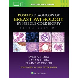 Rosen's Diagnosis of Breast Pathology by Needle Core Biopsy