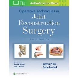 Operative Techniques in Joint Reconstruction Surgery