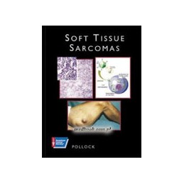 SOFT TISSUE SARCOMAS...