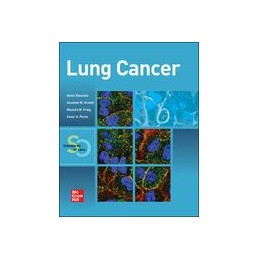 Lung Cancer: Standards of Care