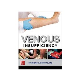 Venous Insufficiency