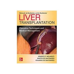 Liver Transplantation:...