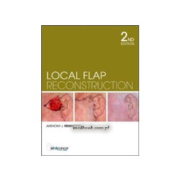 Local Flap Reconstruction