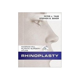 Rhinoplasty