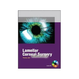 Lamellar Corneal Surgery