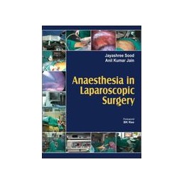 Anaesthesia in Laparoscopic Surgery