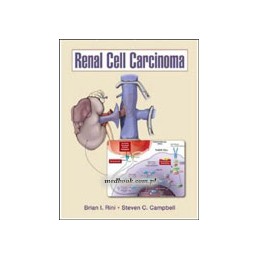 Renal Cell Carcinoma