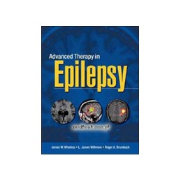 Advanced Therapy in Epilepsy