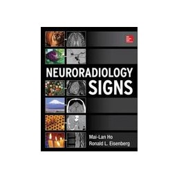 Neuroradiology Signs