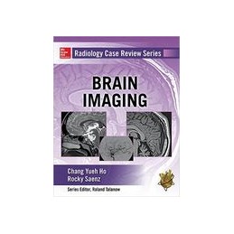 Radiology Case Review Series: Brain Imaging