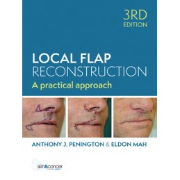 Local Flap Reconstruction, 3rd Edition