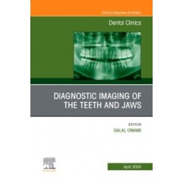 Diagnostic Imaging of the Teeth and Jaws, An Issue of Dental Clinics of North America