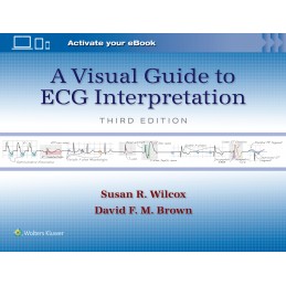 A Visual Guide to ECG Interpretation: Print + digital version with Multimedia