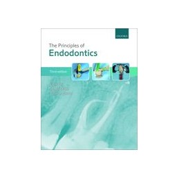 The Principles of Endodontics