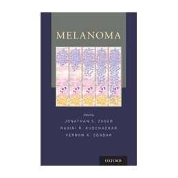 Melanoma