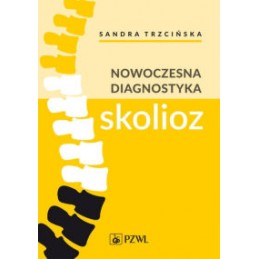 Nowoczesna diagnostyka skolioz