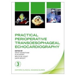 Practical Perioperative Transoesophageal Echocardiography