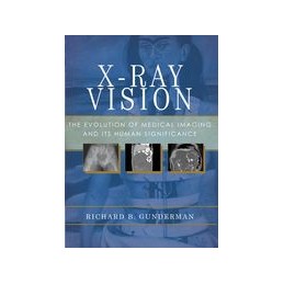 X-Ray Vision