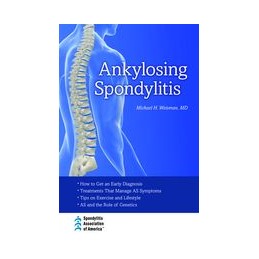 Ankylosing Spondylitis