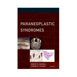 Paraneoplastic Syndromes