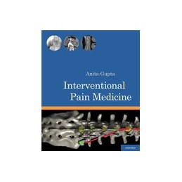 Interventional Pain Medicine