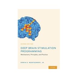 Deep Brain Stimulation...