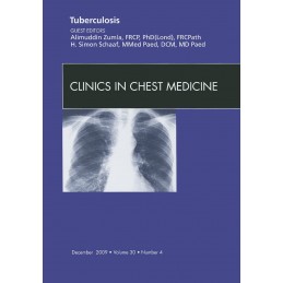 Tuberculosis, An Issue of...