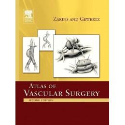 Atlas Of Vascular Surgery -...