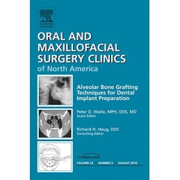 Alveolar Bone Grafting...