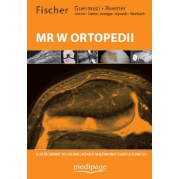 MR w ortopedii -...