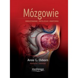 Mózgowie