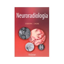 Neuroradiologia