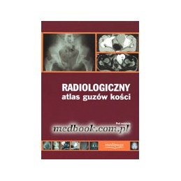 Radiologiczny atlas guzów...