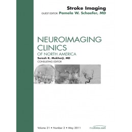 Stroke Imaging, An Issue of...